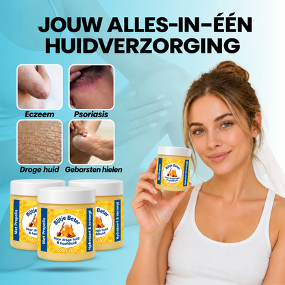 Bijtje Beter – Hormoonvrije balsem voor eczeem & psoriasis