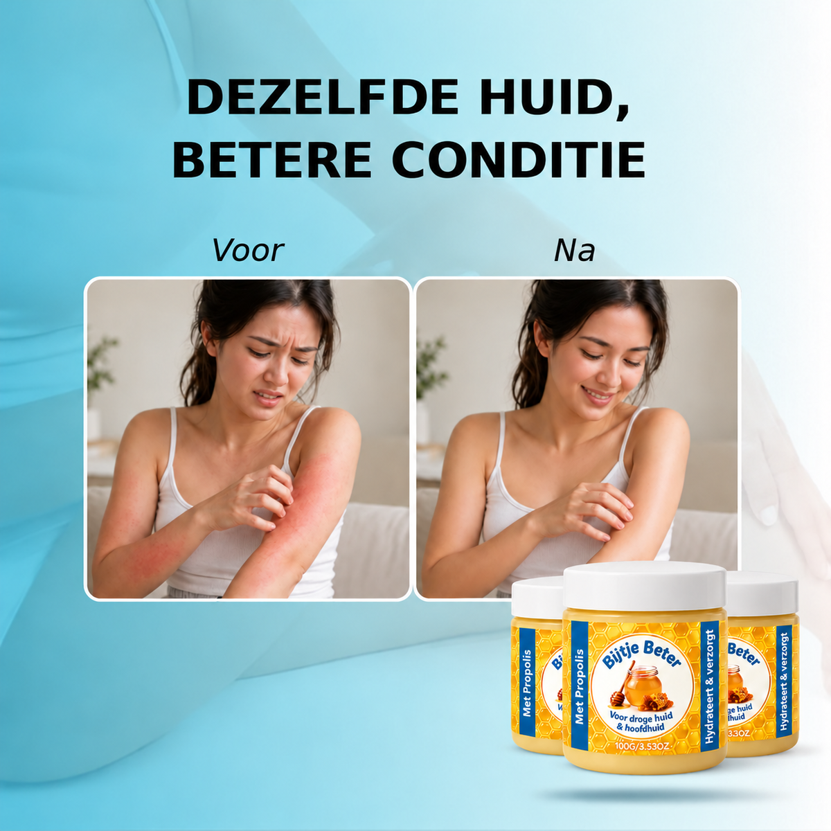 Bijtje Beter – Hormoonvrije balsem voor eczeem & psoriasis